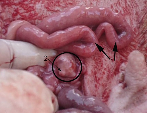 laparotomy-uterus-ovary.jpg